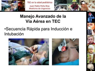 Manejo Avanzado de la
         Vía Aérea en TEC
•Secuencia Rápida para Inducción e
Intubación
 