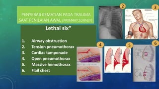Comprehensive Overview of Thoracic and Abdominal Trauma Management | PDF
