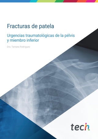 Fracturas de patela
Urgencias traumatológicas de la pélvis
y miembro inferior
Dra. Tamara Rodriguez
 