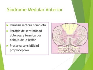Síndrome Medular Anterior
 Parálisis motora completa
 Perdida de sensibilidad
dolorosa y térmica por
debajo de la lesión
 Preserva sensibilidad
propioceptiva
 