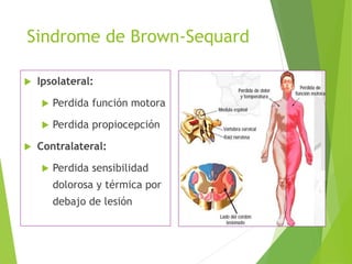 Sindrome de Brown-Sequard
 Ipsolateral:
 Perdida función motora
 Perdida propiocepción
 Contralateral:
 Perdida sensibilidad
dolorosa y térmica por
debajo de lesión
 