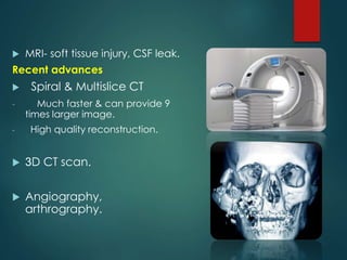  MRI- soft tissue injury, CSF leak.
Recent advances
 Spiral & Multislice CT
- Much faster & can provide 9
times larger image.
- High quality reconstruction.
 3D CT scan.
 Angiography,
arthrography.
 