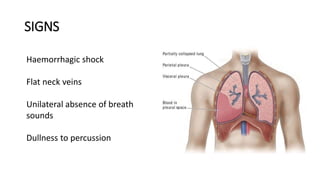 SIGNS
Haemorrhagic shock
Flat neck veins
Unilateral absence of breath
sounds
Dullness to percussion
 