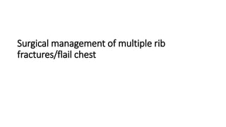 Surgical management of multiple rib
fractures/flail chest
 