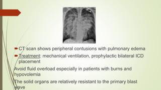 Response to Trauma And Blast and Gunshot Injuries | PPTX