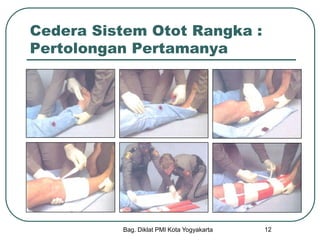 Bag. Diklat PMI Kota Yogyakarta 12
Cedera Sistem Otot Rangka :
Pertolongan Pertamanya
 