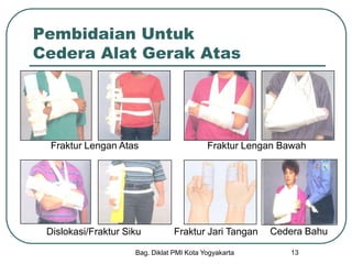 Bag. Diklat PMI Kota Yogyakarta 13
Pembidaian Untuk
Cedera Alat Gerak Atas
Fraktur Lengan Atas
Dislokasi/Fraktur Siku
Fraktur Lengan Bawah
Fraktur Jari Tangan Cedera Bahu
 