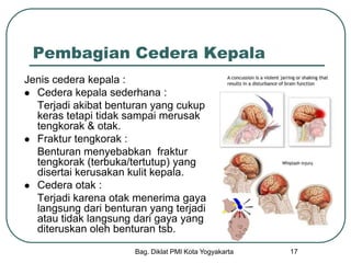 Bag. Diklat PMI Kota Yogyakarta 17
Pembagian Cedera Kepala
Jenis cedera kepala :
 Cedera kepala sederhana :
Terjadi akibat benturan yang cukup
keras tetapi tidak sampai merusak
tengkorak & otak.
 Fraktur tengkorak :
Benturan menyebabkan fraktur
tengkorak (terbuka/tertutup) yang
disertai kerusakan kulit kepala.
 Cedera otak :
Terjadi karena otak menerima gaya
langsung dari benturan yang terjadi
atau tidak langsung dari gaya yang
diteruskan oleh benturan tsb.
 
