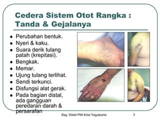 Bag. Diklat PMI Kota Yogyakarta 3
Cedera Sistem Otot Rangka :
Tanda & Gejalanya
 Perubahan bentuk.
 Nyeri & kaku.
 Suara derik tulang
patah (krepitasi).
 Bengkak.
 Memar.
 Ujung tulang terlihat.
 Sendi terkunci.
 Disfungsi alat gerak.
 Pada bagian distal,
ada gangguan
peredaran darah &
persarafan
 
