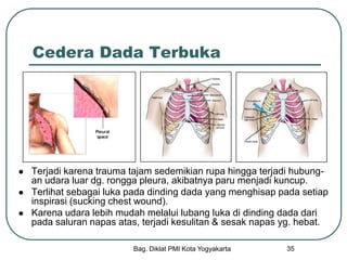 Bag. Diklat PMI Kota Yogyakarta 35
Cedera Dada Terbuka
 Terjadi karena trauma tajam sedemikian rupa hingga terjadi hubung-
an udara luar dg. rongga pleura, akibatnya paru menjadi kuncup.
 Terlihat sebagai luka pada dinding dada yang menghisap pada setiap
inspirasi (sucking chest wound).
 Karena udara lebih mudah melalui lubang luka di dinding dada dari
pada saluran napas atas, terjadi kesulitan & sesak napas yg. hebat.
 