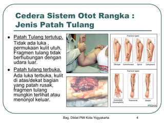 Bag. Diklat PMI Kota Yogyakarta 4
Cedera Sistem Otot Rangka :
Jenis Patah Tulang
 Patah Tulang tertutup.
Tidak ada luka ,
permukaan kulit utuh,
Fragmen tulang tidak
berhubungan dengan
udara luar.
 Patah tulang terbuka.
Ada luka terbuka, kulit
di atas/dekat bagian
yang patah rusak,
fragmen tulang
mungkin terlihat atau
menonjol keluar.
 