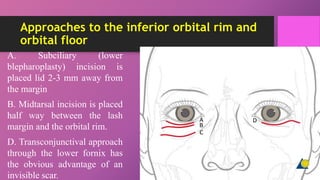 Subciliary Approach Incision Trauma 3 | PPTX