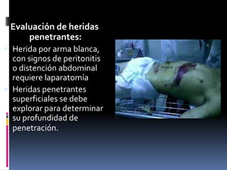 Evaluación de heridas
penetrantes:
 Herida por arma blanca,
con signos de peritonitis
o distención abdominal
requiere laparatomía
 Heridas penetrantes
superficiales se debe
explorar para determinar
su profundidad de
penetración.
 