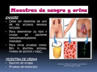 SANGRE
• Debe ser obtenida de uno
de los accesos venosos
iniciales.
• Para determinar su tipo y
cruzar en paciente
hemodinámicamente
inestable.
• Para otras pruebas como:
BH, k, glucosa, amilasa,
niveles de alcohol y HGC.
MUESTRA DE ORINA
• Rastreo de drogas
• Pruebas de embarazo.
American College of surgeons, committe on
trauma.chicago, III, 2005.
Muestras de sangre y orina
 
