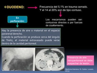 Frecuencia del 5,1% en trauma cerrado.
Y el 14 al 20% son de tipo contuso.
Los mecanismos pueden ser:
contusivos directos o por fuerzas
de cizallamiento.
En
perforación:
Hay la presencia de aire o material en el espacio
pararenal derecho.
Cuando la perforación se produce cerca del ángulo
de Treitz, el material extravasado puede verse
dentro de la cavidad peritoneal.
Presencia de aire
retroperitoneal se debe
sospechar de lesión.
Medicina Intensiva. Dr. Carlos Lovesio.
ATLS
 