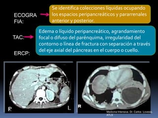 ECOGRA
FIA:
Se identifica colecciones líquidas ocupando
los espacios peripancreáticos y pararrenales
anterior y posterior.
TAC:
Edema o líquido peripancreático, agrandamiento
focal o difuso del parénquima, irregularidad del
contorno o línea de fractura con separación a través
del eje axial del páncreas en el cuerpo o cuello.
ERCP:
Medicina Intensiva. Dr. Carlos Lovesio.
ATLS
 