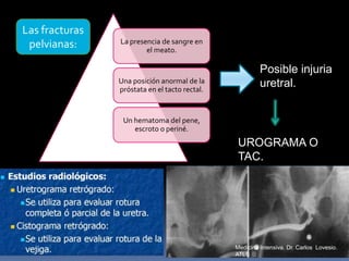 La presencia de sangre en
el meato.
Una posición anormal de la
próstata en el tacto rectal.
Un hematoma del pene,
escroto o periné.
Las fracturas
pelvianas:
Posible injuria
uretral.
UROGRAMA O
TAC.
Medicina Intensiva. Dr. Carlos Lovesio.
ATLS
 
