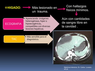 HIGADO: Más lesionado en
un trauma.
Con hallazgos
físicos mínimos.
Aún con cantidades
de sangre libre en
la cavidad .
• Apareciendo imágenes
heterogéneas, hiper o
hipoecogénicas,
compatibles con diversas
lesiones hepáticas.
ECOGRAFIA
• Más sensible para el
diagnóstico.TAC
Medicina Intensiva. Dr. Carlos Lovesio.
ATLS
 