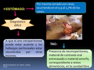 ESTÓMAGO:
Por trauma cerrado son raras,
ocurriendo en el 0,9 al 1,7% de los
casos.
A que el aire intraperitoneal
puede estar ausente y los
hallazgos peritoneales estar
oscurecidos por otras
lesiones.
Diagnóstico
difícil
TAC:
Presencia de neumoperitoneo,
material de contraste oral
extravasado o material amorfo,
correspondiente a restos
alimenticios, en la cavidad libre.
Medicina Intensiva. Dr. Carlos Lovesio.
ATLS
 