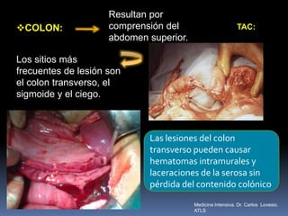 COLON:
Resultan por
comprensión del
abdomen superior.
Los sitios más
frecuentes de lesión son
el colon transverso, el
sigmoide y el ciego.
Las lesiones del colon
transverso pueden causar
hematomas intramurales y
laceraciones de la serosa sin
pérdida del contenido colónico
TAC:
Medicina Intensiva. Dr. Carlos Lovesio.
ATLS
 