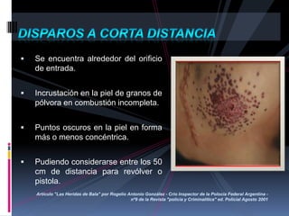  Se encuentra alrededor del orificio
de entrada.
 Incrustación en la piel de granos de
pólvora en combustión incompleta.
 Puntos oscuros en la piel en forma
más o menos concéntrica.
 Pudiendo considerarse entre los 50
cm de distancia para revólver o
pistola.
Artículo "Las Heridas de Bala" por Rogelio Antonio González - Crio Inspector de la Polocía Federal Argentina -
nº9 de la Revista "policía y Criminalítica" ed. Policial Agosto 2001
 