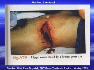 Sumber: Walt Alan Stoy dkk, EMT-Basic Textbook, 2 nd ed, Mosby, 2005 Gambar : Luka tusuk 