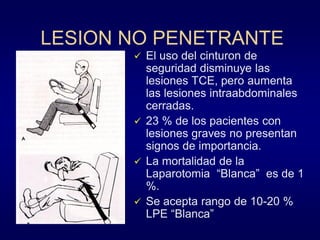 LESION NO PENETRANTE


El uso del cinturon de
seguridad disminuye las
lesiones TCE, pero aumenta
las lesiones intraabdominales
cerradas.
 23 % de los pacientes con
lesiones graves no presentan
signos de importancia.
 La mortalidad de la
Laparotomia “Blanca” es de 1
%.
 Se acepta rango de 10-20 %
LPE “Blanca”

 
