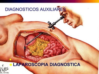 DIAGNOSTICOS AUXILIARES



 LAPAROSCOPIA

DIAGNOSTICA

 