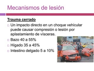 Mecanismos de lesión Trauma cerradoUn impacto directo en un choque vehicular puede causar compresión o lesión por aplastamiento de vísceras.Bazo 40 a 55%Hígado 35 a 45%Intestino delgado 5 a 10%