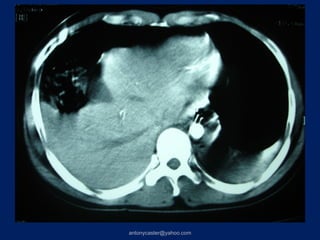 antonycaster@yahoo.com
 