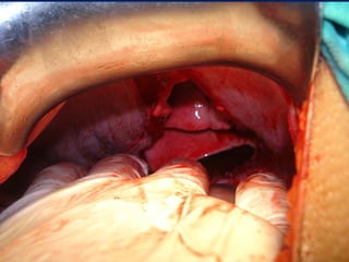 antonycaster@yahoo.com
 