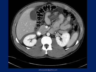 antonycaster@yahoo.com
 