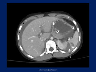 antonycaster@yahoo.com
 