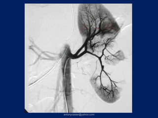 antonycaster@yahoo.com
 