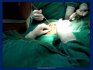 antonycaster@yahoo.com
 