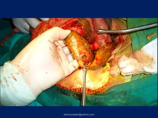 antonycaster@yahoo.com
 