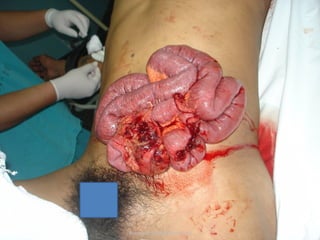 antonycaster@yahoo.com
 