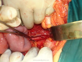 antonycaster@yahoo.com
 