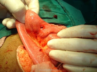 antonycaster@yahoo.com
 