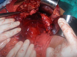 antonycaster@yahoo.com
 