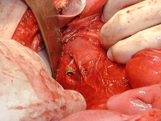 antonycaster@yahoo.com
 