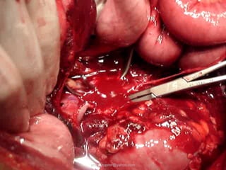 antonycaster@yahoo.com
 