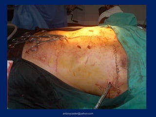 antonycaster@yahoo.com
 