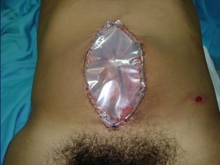 antonycaster@yahoo.com
 