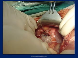 antonycaster@yahoo.com
 