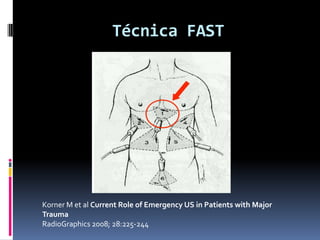 Técnica FAST




Korner M et al Current Role of Emergency US in Patients with Major
Trauma
RadioGraphics 2008; 28:225-244
 