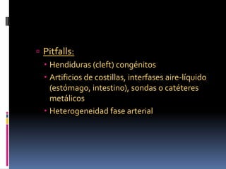  Pitfalls:
   Hendiduras (cleft) congénitos
   Artificios de costillas, interfases aire-líquido
    (estómago, intestin...