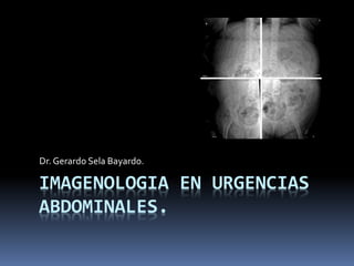 IMAGENOLOGIA EN URGENCIAS
ABDOMINALES.
Dr. Gerardo Sela Bayardo.
 