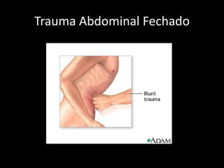 Trauma Abdominal Fechado 
 