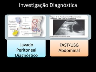 Investigação Diagnóstica 
Lavado 
Peritoneal 
Diagnóstico 
FAST/USG 
Abdominal 
 